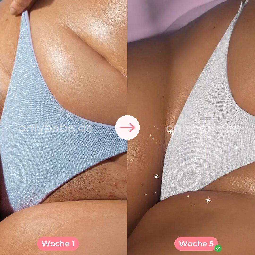 ONLYBABE IPL PRO™